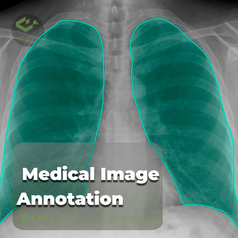 The Ultimate Medical Image Annotation Guide