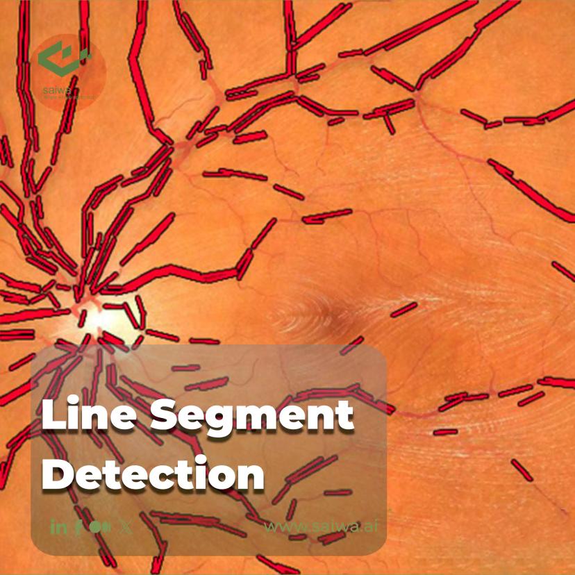 Line Segment Detection