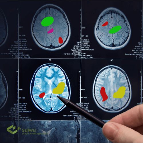 What makes medical image annotation different from traditional labeling?